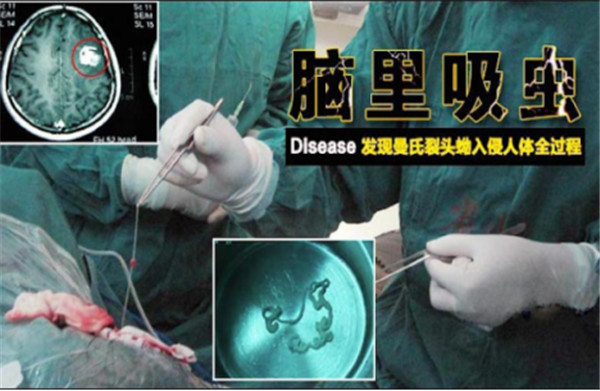 關(guān)注健康，防治食源性寄生蟲感染